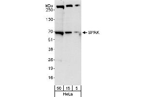 anti-serine threonine Kinase 39 (STK39) (AA 375-425) antibody