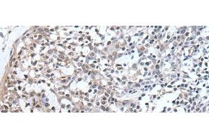 Immunohistochemistry of paraffin-embedded Human tonsil tissue using PLAG1 Polyclonal Antibody at dilution of 1:25(x200) (PLAG1 antibody)