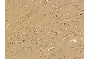 PMPCA Mouse Monoclonal Antibody at 1/100 staining mouse brain tissue by IHC-P. (PMPCA antibody)
