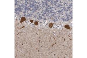 Immunohistochemical staining of human cerebellum with DLG2 polyclonal antibody  shows strong cytoplasmic positivity in Purkinje cells at 1:200-1:500 dilution. (DLG2 antibody)