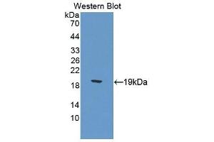 Detection of Recombinant CTR, Mouse using Polyclonal Antibody to Calcitonin Receptor (CTR) (Calcitonin Receptor antibody  (AA 42-170))