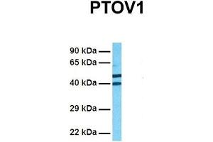 Host:  Rabbit  Target Name:  PTOV1  Sample Tissue:  Human 293T  Antibody Dilution:  1. (PTOV1 antibody  (N-Term))