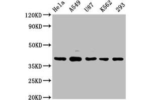 Western Blot Positive WB detected in: Hela whole cell lysate, A549 whole cell lysate, U87 whole cell lysate, K562 whole cell lysate, 293 whole cell lysate All lanes: PIH1D1 antibody at 1:2000 Secondary Goat polyclonal to rabbit IgG at 1/50000 dilution Predicted band size: 33, 20, 22 kDa Observed band size: 39 kDa (PIH1D1 antibody  (AA 1-290))