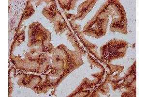 IHC image of ABIN7159037 diluted at 1:800 and staining in paraffin-embedded human prostate tissue performed on a Leica BondTM system. (MAML2 antibody  (AA 347-506))