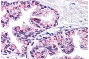 Human Prostate (formalin-fixed, paraffin-embedded) stained with PHKG2 antibody ABIN214802 at 5 ug/ml followed by biotinylated goat anti-rabbit IgG secondary antibody ABIN481713, alkaline phosphatase-streptavidin and chromogen. (PHKG2 antibody  (N-Term))