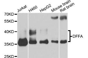 Western blot analysis of extracts of various cell lines, using DFFA antibody. (DFFA antibody  (AA 1-331))