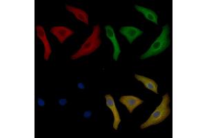 Cytokeratin 17 Mouse Monoclonal Antibody staining Hela cells by IF/ICC.