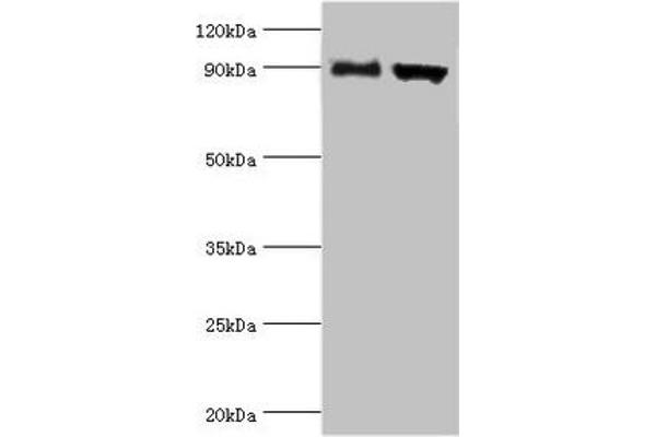 ADAM9 antibody  (AA 475-685)