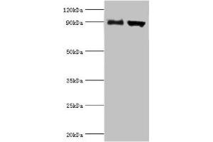 Western blot All lanes: Disintegrin and metalloproteinase domain-containing protein 9 antibody at 2 μg/mL Lane 1: Mouse liver tissue Lane 2: Mouse heart tissue Secondary Goat polyclonal to rabbit IgG at 1/10000 dilution Predicted band size: 91, 73 kDa Observed band size: 91 kDa (ADAM9 antibody  (AA 475-685))