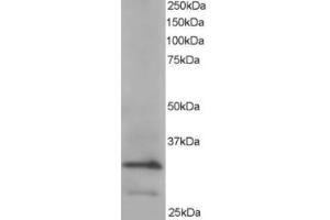 Western Blotting (WB) image for anti-Actin Related Protein 2/3 Complex, Subunit 2, 34kDa (ARPC2) (C-Term) antibody (ABIN2465173) (ARPC2 antibody  (C-Term))