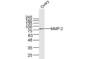 Rat ovary lysates probed with MMP-2 Polyclonal Antibody, Unconjugated  at 1:300 dilution and 4˚C overnight incubation. (MMP2 antibody  (AA 81-150))