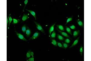 Immunofluorescence staining of A549 cells with ABIN7168378 at 1:166, counter-stained with DAPI. (MSI1 antibody  (AA 221-347))