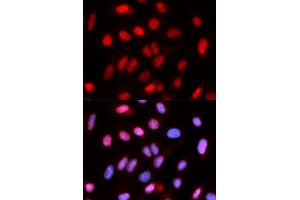 Immunofluorescence analysis of U2OS cells using RFC4 antibody (ABIN5973195). (RFC4 antibody)