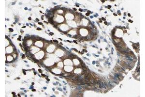 ABIN6267020 at 1/100 staining human Rectum tissue sections by IHC-P. (APC antibody  (pSer2054))