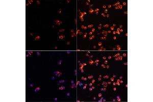 Immunofluorescence analysis of Jurkat cells using CASP3 antibody (ABIN6292881) at dilution of 1:100. (Caspase 3 antibody)