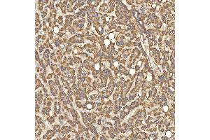 IHC analysis of Citrin/SLC25A13 using anti-Citrin/SLC25A13 antibody (ABIN7599512). (slc25a13 antibody  (AA 1-643))
