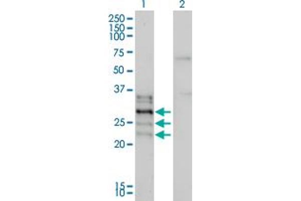 NFATC2IP antibody  (AA 1-138)