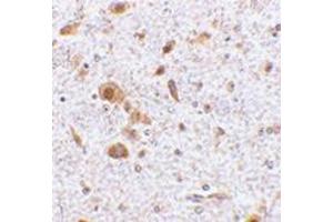 Immunohistochemistry of TSLP in Mouse brain tissue with AP30965PU-N TSLP antibody at 2. (Thymic Stromal Lymphopoietin antibody  (Center))