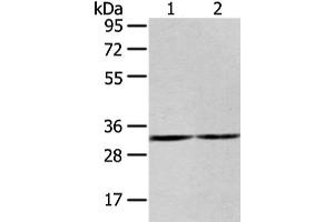 ZNF146 anticorps
