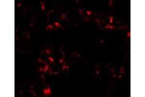 Immunofluorescence analysis of FOXRED2 in human lung with FOXRED2 polyclonal antibody  at 20 ug/mL. (FOXRED2 antibody  (N-Term))
