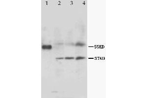 Anti-MRGX1 antibody, Western blotting Lane 1: Marker Lane 2: Rat Heart Tissue Lysate Lane 3: Rat Skeletal Muscle Tissue Lysate Lane 4: MCF-7 Cell Lysate (MRGPRX1 antibody  (N-Term))