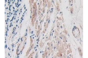 Immunohistochemistry (IHC) image for anti-Inter-alpha Trypsin Inhibitor, Heavy Chain 1 (ITIH1) (AA 507-819) antibody (ABIN7436564)