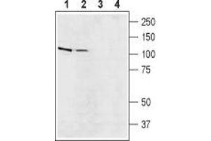 Western blot analysis of rat (lanes 1 and 3) and mouse (lanes 2 and 4) brain lysates: - 1,2. (SLC9A5 antibody  (C-Term, Intracellular))