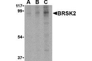 Western Blotting (WB) image for anti-BR serine/threonine Kinase 2 (BRSK2) (C-Term) antibody (ABIN1030303) (BRSK2 antibody  (C-Term))