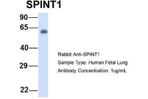 Host:  Rabbit  Target Name:  SPINT1  Sample Type:  Human Fetal Lung  Antibody Dilution:  1.