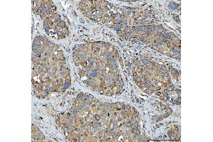 IHC analysis of Tripeptidyl peptidase II/TPPII/TPP2 using anti-Tripeptidyl peptidase II/TPPII/TPP2 antibody (ABIN7601293).