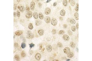 anti-Papillary Renal Cell Carcinoma (Translocation-Associated) (PRCC) (AA 125-175) antibody