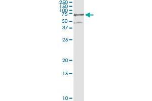 Western Blotting (WB) image for anti-Phosphoglucomutase 3 (PGM3) (AA 1-543) antibody (ABIN598868) (Phosphoglucomutase 3 antibody  (AA 1-543))