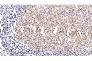 Immunohistochemistry (IHC) image for anti-Intercellular Adhesion Molecule 1 (ICAM1) (AA 41-464) antibody (ABIN7425926)