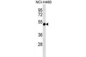 Western Blotting (WB) image for anti-Rhabdoid Tumor Deletion Region Gene 1 (RTDR1) antibody (ABIN2997232)