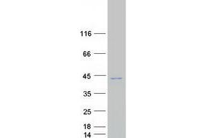 Validation with Western Blot