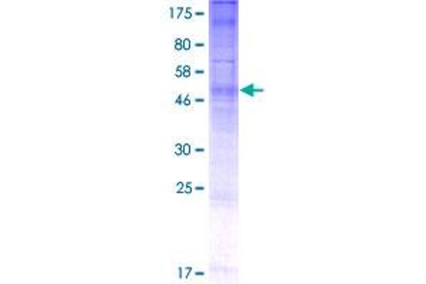 PGAP3 Protein (AA 1-320) (GST tag)