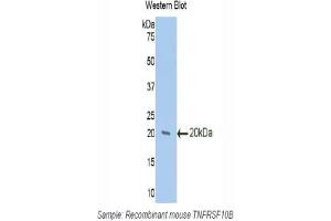 Western blot analysis of the recombinant protein. (TNFRSF10B antibody  (AA 233-367))