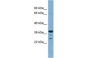 WB Suggested Anti-DHRS9 Antibody Titration: 0.