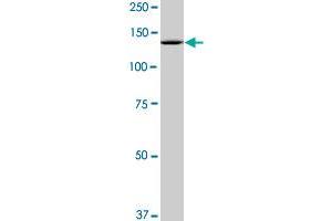 SF3B2 monoclonal antibody (M10), clone 2A2. (SF3B2 antibody  (AA 1-636))