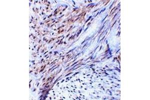 Immunohistochemistry (IHC) image for anti-Tripartite Motif Containing 5 (TRIM5) (Middle Region 2) antibody (ABIN1031206) (TRIM5 antibody  (Middle Region 2))