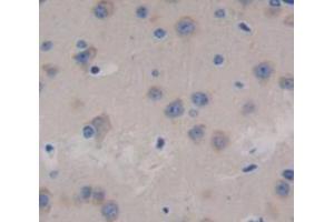 IHC-P analysis of brain tissue, with DAB staining. (FBXL3 antibody  (AA 1-292))