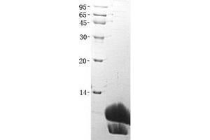 Validation with Western Blot (SCGB3A2 Protein (His tag))