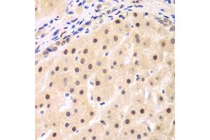 Immunohistochemistry (IHC) image for anti-NF-kappa-B inhibitor beta (NFKBIB) (AA 1-356) antibody (ABIN6144584)