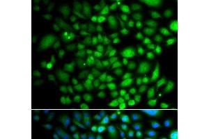 Immunofluorescence analysis of A549 cells using PTK6 Polyclonal Antibody (PTK6 antibody)