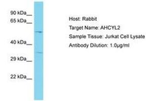 Image no. 1 for anti-Adenosylhomocysteinase-Like 2 (AHCYL2) (AA 50-99) antibody (ABIN6750591) (AHCYL2 antibody  (AA 50-99))