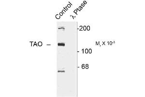 Western blots of rat cortex lysate showing specific immunolabeling of the ~120k TAO2 phosphorylated at Ser181 (Control). (TAO Kinase 2 antibody  (pSer181))