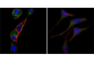 Immunofluorescence analysis of PC-3 (left) and SK-BR-3 (right) cells using anti-GOT2 mAb (green).