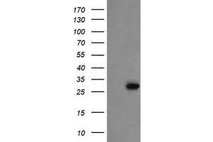 Image no. 1 for anti-Proline Synthetase Co-Transcribed (PROSC) antibody (ABIN1500441) (PROSC antibody)