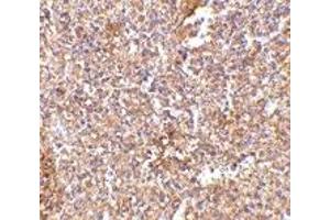 Immunohistochemistry (IHC) image for anti-Six Transmembrane Epithelial Antigen of The Prostate 1 (STEAP1) (Middle Region) antibody (ABIN1031108) (STEAP1 antibody  (Middle Region))