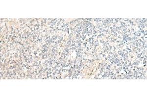 Immunohistochemistry of paraffin-embedded Human tonsil tissue using SNRPD1 Polyclonal Antibody at dilution of 1:70(x200) (SNRPD1 antibody)